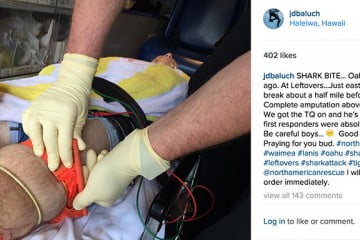 Un surfista perdió su pierna en Hawaii por el ataque de un tiburón
